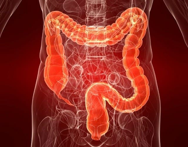 C Mo Combatir La Colitis Ulcerosa Quesalud