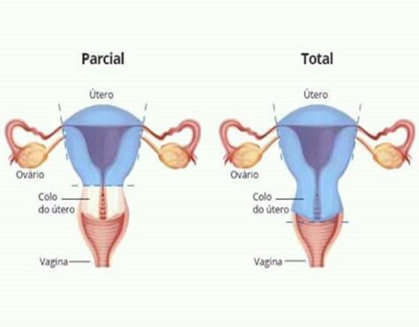Anatomia Utero Cervix Vagina Y Trompas Parte I Flashcards Easy Sexiz Pix