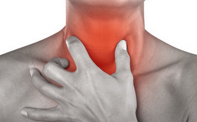 Mononucleosis infecciosa: causas, sÃ­ntomas y prevenciÃ³n